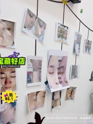 -skin79皮肤管理中心