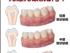 -上海仁爱医院口腔科 · 种植