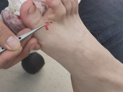 -新甲连锁灰指甲·甲沟炎·鸡眼(黑龙江路店)