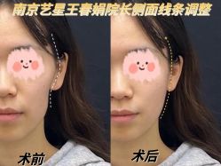 -Yestar艺星医疗美容医院
