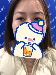 体验前-郡艺医疗美容·微整·眼鼻吸脂