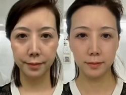 -上海伊莱美医疗美容医院
