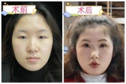 -素美医疗美容·西南眼鼻整形·修复基地
