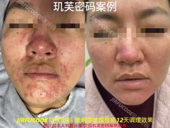 -元熙兰积皮肤管理