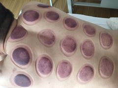 -欣康盲人按摩(西里小区欣里园店)