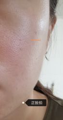 -正璞医疗美容·皮肤修复·微整注射