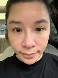 -美丽人生祛斑扁平疣汗管瘤中心