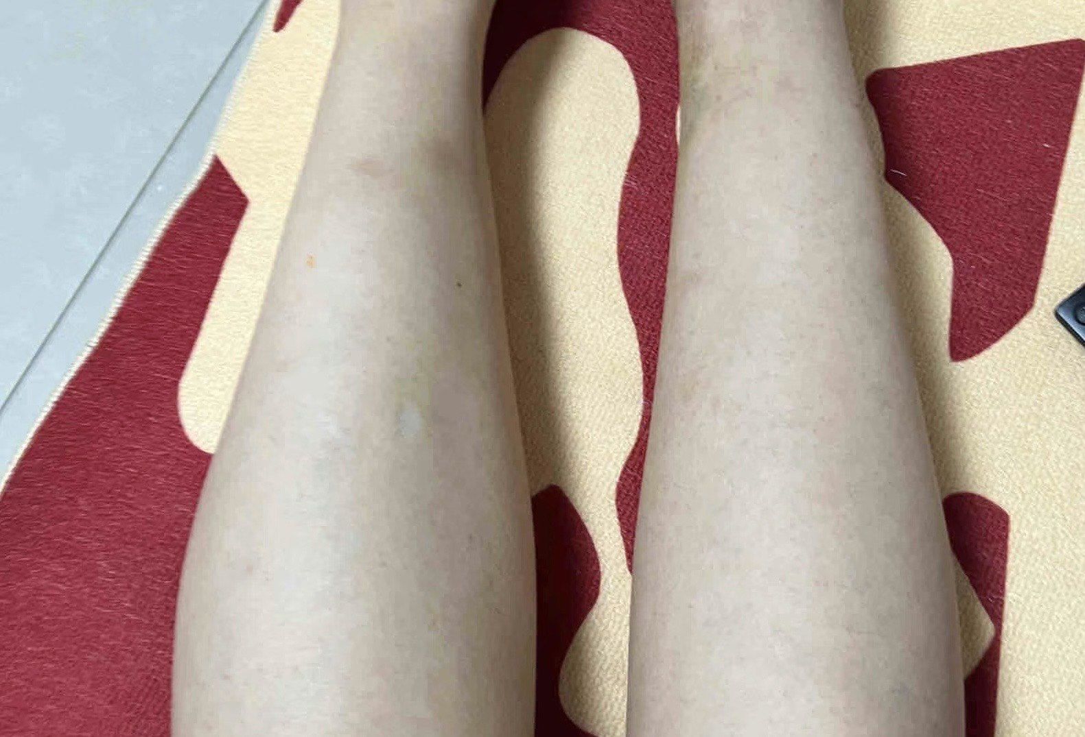 原来户外骑自行车练得很粗的腿肌肉也都消失下去了

夜晚户外骑行