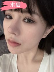 -素美医疗美容·西南眼鼻整形·修复基地