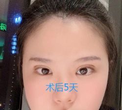 -成都西区医院整形美容