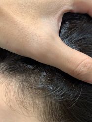 -熙朵美学植发连锁