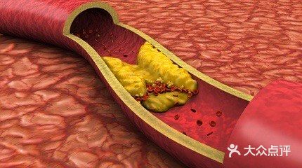 护血管、促循环，受益一辈子
