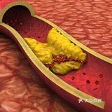 护血管、促循环，受益一辈子