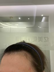 -亿美医疗美容·半岛大超炮官方授权店