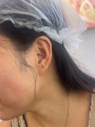 -长沙雅美医疗美容医院
