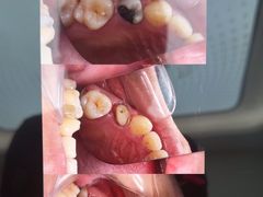 -牙博士口腔品牌连锁(杨浦店)