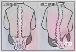 -香薇妮丝女子减肥院