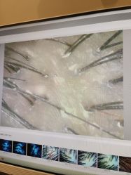 -史云逊养发护发