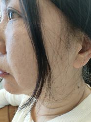 -长沙雅美医疗美容医院