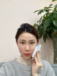 体验后-上海首尔丽格医疗美容医院