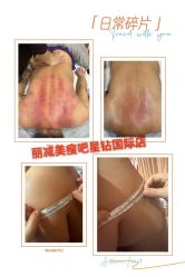 -丽减美瘦吧·减肥瘦身