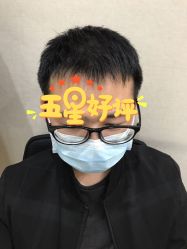 -大麦微针植发全国连锁