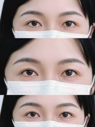 点击看大图 -Doris多里斯半永久纹眉·SMP纹发·发际线