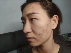 -蕾特恩专业祛痘·皮肤管理