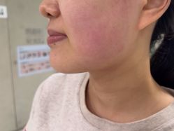 -Yestar艺星整形美容医院