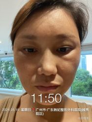 -广东韩妃整形外科医院