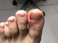 -新甲连锁灰指甲·甲沟炎·鸡眼(黑龙江路店)