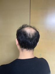 -极客侠男士假发定制补发
