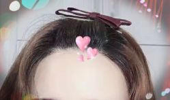 -大麦微针植发全国连锁