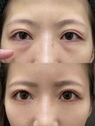 -紫洁俪方（北京）医疗美容