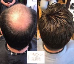 -发饰美男士增发补发假发定制店