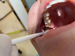 -宁波壹加壹口腔·矫正种植中心