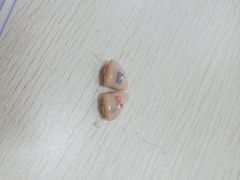-惠耳听力助听器经营部(东风北路店)