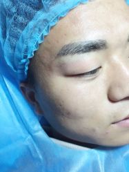 -尚玲纹绣纹眉特价店