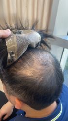 -发饰美男士增发补发假发定制店