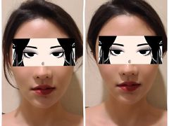 -FACE·日本小颜美容整骨(福田店)