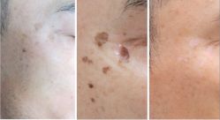 -SKINIST丽铂医疗美容