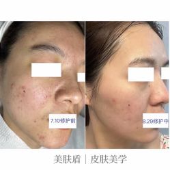 -美肤盾祛痘·问题肌头疗管理中心