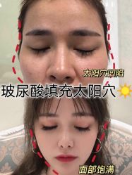 -Yestar宁波艺星整形医院