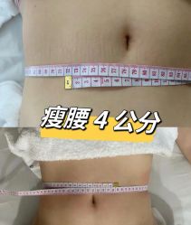 点击看大图 -Lily纤美·科技减脂中心