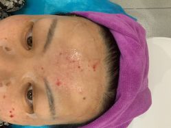 -北京米扬丽格医疗美容·联合丽格鼻整形中心