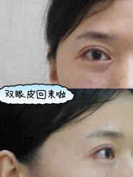 -深圳艺星医疗美容医院