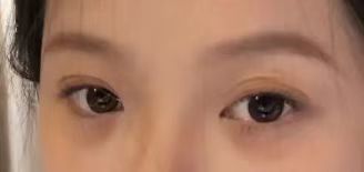 -紫洁俪方（北京）医疗美容