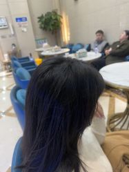 -碧莲盛·不剃发植发