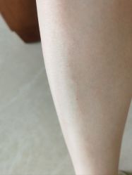 -SKIN79皮肤管理中心