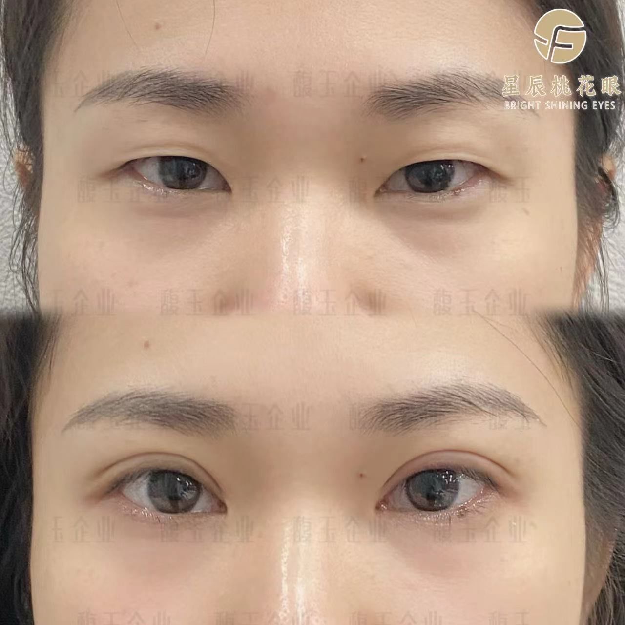 94星辰桃花眼
护士小姐姐说 从今天